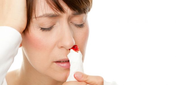 Krwawienie z nosa – 10 sposobów, by je zatrzymać